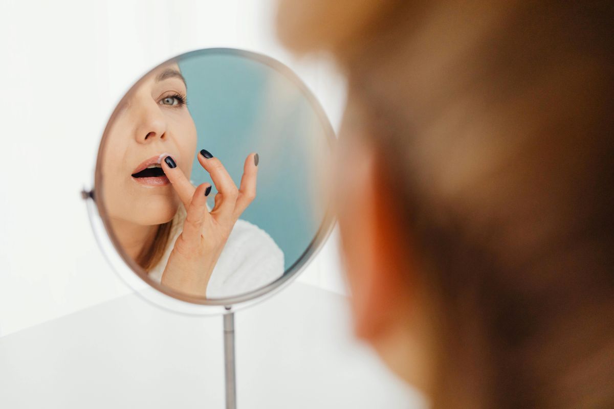 Hormonale acne op de kaaklijn bij een volwassen vrouw